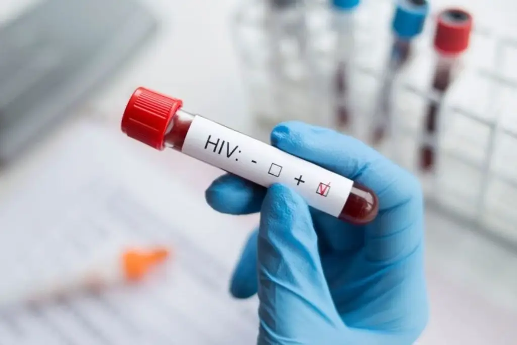 Descubren un anticuerpo que puede neutralizar el VIH